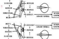 胆碱酯酶正常标准是多少？ 胆碱酯酶的临床意义