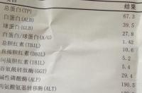 碱性磷酸酶偏高是怎么回事呢？ 碱性磷酸酶600多是癌症吗