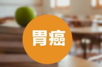 胃癌前期五个身体信号