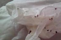 狗狗得了蜱虫能用依维菌素吗？ 狗身上有蜱虫用什么药杀死