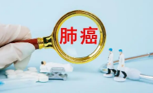 肺癌放疗的副作用有哪些症状
