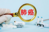 肺癌放疗的副作用有哪些症状