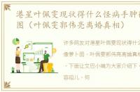 港星叶佩雯现状得什么怪病手肿得像萝卜图（叶佩雯郭伟亮离婚真相）