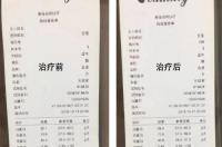 吃什么药降低胆红素？ 降胆红素保肝最好的药