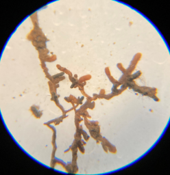 山毛榉叶病的滚雪球效应伤害了有益的根真菌