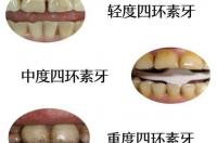四环素是什么类药物？ 四环素片是治什么的