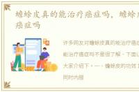 蟾蜍皮真的能治疗癌症吗，蟾蜍皮能治疗癌症吗