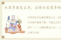 头屑多要怎么办，去除头皮屑多的小妙招