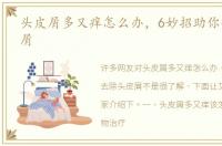头皮屑多又痒怎么办，6妙招助你去除头皮屑
