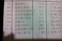 肌酐偏低是什么原因？ 肌酐偏低的原因