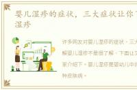婴儿湿疹的症状，三大症状让你了解婴儿湿疹