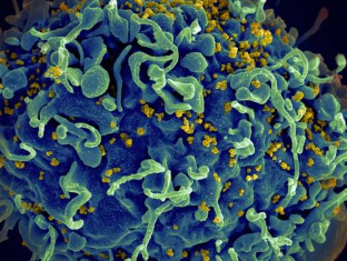 研究人员在首个人体纳米颗粒HIV疫苗中发现了强烈的T细胞反应