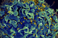 研究人员在首个人体纳米颗粒HIV疫苗中发现了强烈的T细胞反应