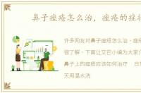 鼻子痤疮怎么治，痤疮的症状