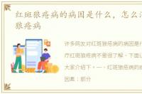 红斑狼疮病的病因是什么，怎么治疗红斑狼疮病