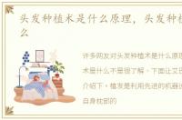头发种植术是什么原理，头发种植术是什么