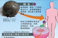 蜱虫有多大危害？ 蜱虫的样子和危害
