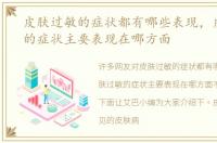皮肤过敏的症状都有哪些表现，皮肤过敏的症状主要表现在哪方面