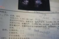 剖腹产为什么要挂抗生素,为什么打肝素还会胎停呢 为啥停了肝素就胎停了