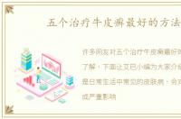 五个治疗牛皮癣最好的方法