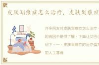 皮肤划痕症怎么治疗，皮肤划痕症的病因