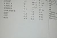 碱性磷酸酶偏低是怎么回事 碱性磷酸酶偏低女性