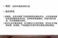 四环素牙内脱色法所用的脱色剂是 四环素牙一代人的悲哀