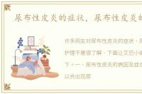 尿布性皮炎的症状，尿布性皮炎的护理