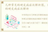 几种常见的硬皮病症状解析图，几种常见的硬皮病症状解析