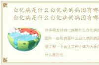 白化病是什么白化病的病因有哪些图片，白化病是什么白化病的病因有哪些