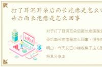 打了耳洞耳朵后面长疙瘩是怎么回事，耳朵后面长疙瘩是怎么回事