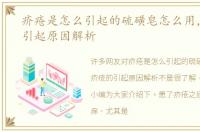 疥疮是怎么引起的硫磺皂怎么用，疥疮的引起原因解析