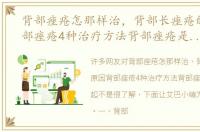 背部痤疮怎那样治，背部长痤疮的原因背部痤疮4种治疗方法背部痤疮是怎样引起