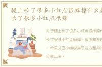 腿上长了很多小红点很痒擦什么药，腿上长了很多小红点很痒