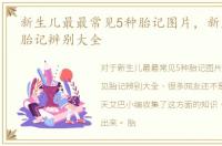 新生儿最最常见5种胎记图片，新生儿常见胎记辨别大全