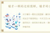 镶牙一颗的过程图解，镶牙的步骤