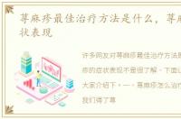 荨麻疹最佳治疗方法是什么，荨麻疹的症状表现