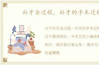 补牙全过程，补牙的手术过程