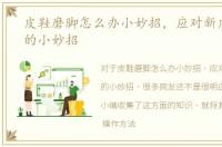 皮鞋磨脚怎么办小妙招，应对新皮鞋磨脚的小妙招