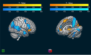 神经科学家利用足球迷的脑部扫描来研究狂热程度
