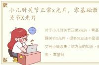 小儿肘关节正常x光片，零基础教你认识踝关节X光片