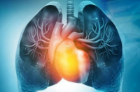 FDA批准Winrevair治疗成人肺动脉高压