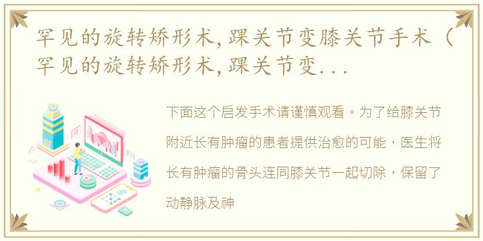 罕见的旋转矫形术,踝关节变膝关节手术（罕见的旋转矫形术,踝关节变膝关节）